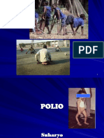 polio dd.ppt