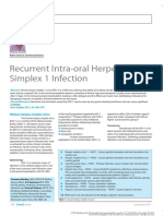 Recurrent Intra Oral Herpes Simplex