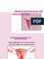 Adenocarcinoma de endometrio