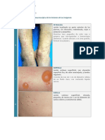 Lesiones Dermis AP PDF