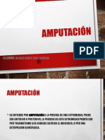 Amputacion