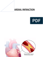 Myocardial Infarction Post RN