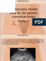 Isabel Rangel Barón - Embarazo Molar, Una de Las Peores Complicaciones, Parte II
