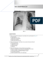 Chest Radio 6 Elevated Diaphragm