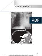 chest radio 7 shift of the mediastinum