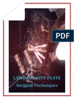 Surgical Techniques Laminoplasty