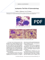 A Case With Pancytopenia The Role of Cytomorphology