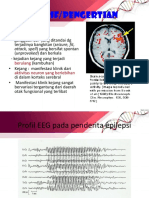 PPT Epilepsi