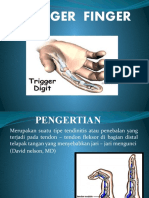 167585443-Trigger-Finger.pptx