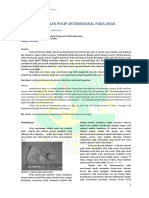 Penatalaksanaan_Polip_Antrokoanal_pada_Anak.pdf