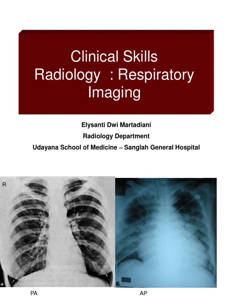 Clinical Skills Radiology Respiratory Imaging Review | PDF | Lung | Thorax
