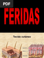 FERIDAS