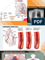 PLANTILLA-DE-EXPOSICION Brandon