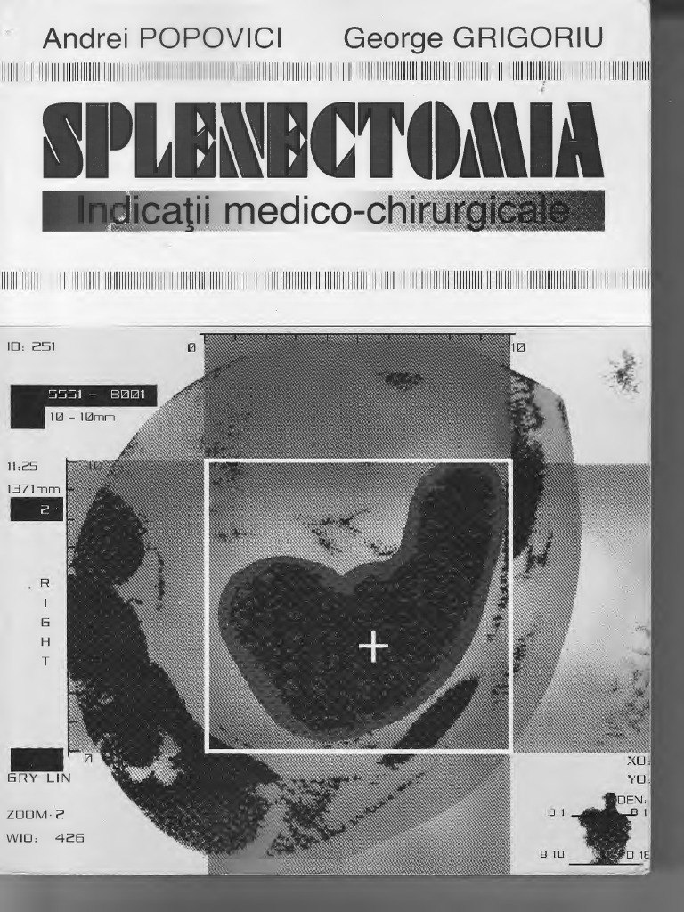 Grigoriu. Popovici - Splenectomia PDF | PDF