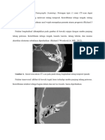 CT-Scan, MRI, dan Pemeriksaan Lain untuk Diagnosis Fraktur Tulang Temporal