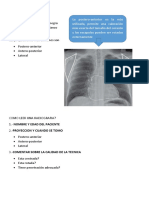 Radiografia de Torax