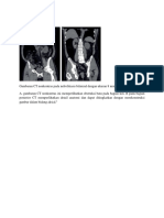 radiologi nefrolitiasis.docx