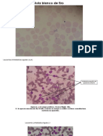 Atlas Final de Hematología