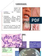 CANDIDIASIS