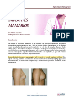 M6ACT2LOB01 Implantes Mamarios