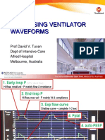 Ventilator Waveforms DavidTuxen2