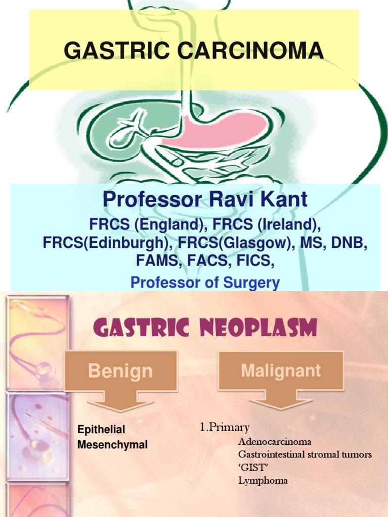 Gastric Carcinoma | PDF | Stomach | Cancer