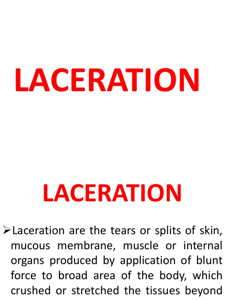 Types and Healing of Lacerations | PDF | Wound | Skin