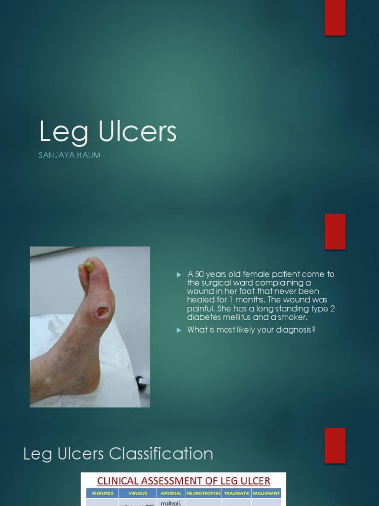 Leg Ulcer | PDF | Wound | Epidemiology