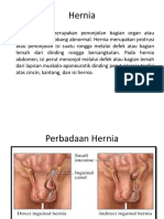 Hernia