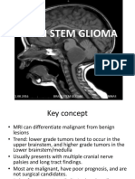 Brainstemglioma 2