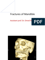 Mandibular Fractures