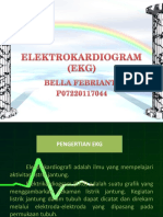 Elektrokardiogram (Ekg)