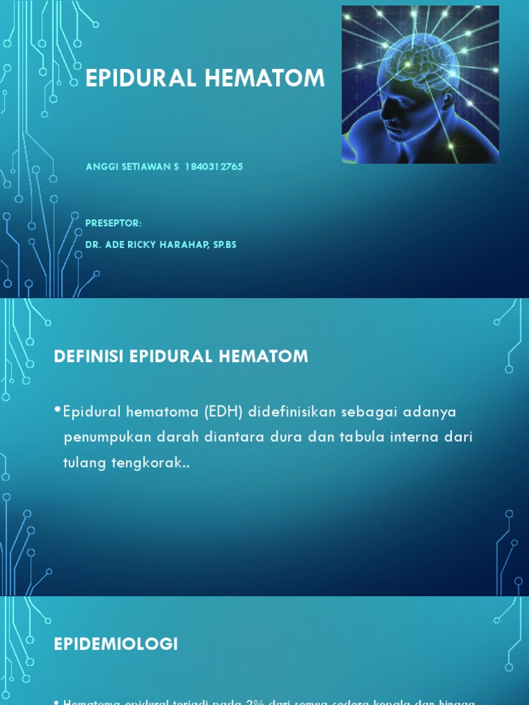Edh | PDF
