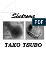 El Síndrome de Tako Tsubo (STS