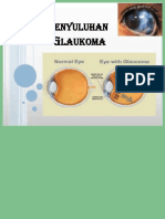 [PDF] penyuluhan glaukoma