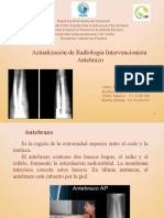 Presentación1 ANTEBRAZO-Editada