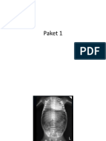 paket 1 baru