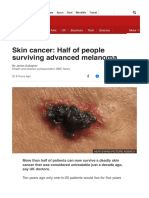 BBC News Article On Cancers