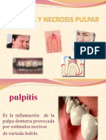 Pulpitis y Necrosis Pulpar