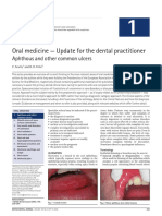1-BDJ, Aphthous and Other Common Ulcers
