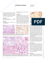 Extrapleural Solitary Fibrous Tumour