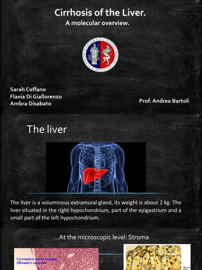 Molecular Overview of Liver Cirrhosis | PDF | Hepatitis | Liver