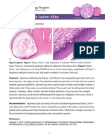 Uterus Cervix Cyst Squamous PDF 508