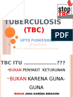 Cara Mencegah Penularan TBC
