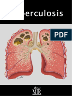 Tuberculosis Curso Mir.pdf