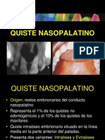 Quiste nasopalatino: Características clínicas y radiográficas