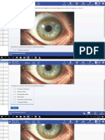 Uworld Step 1 2019 Ophthalmology & ENT PDF