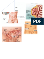 GAMBAR HERNIA.doc