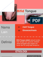 Bifid Tongue