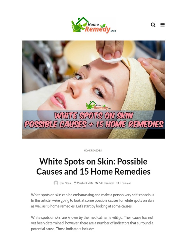 White spots on the skin: Possible causes and treatments